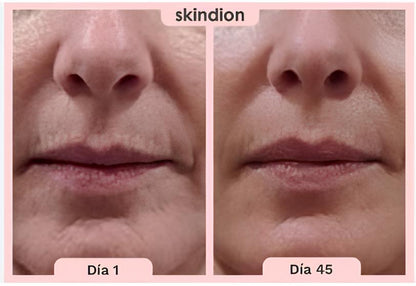 Skindion  Masajeador facial |  Elimina la Flacidez  y Rejuvenece tu Piel en Minutos ⭐