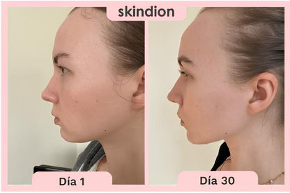 Skindion  Masajeador facial |  Elimina la Flacidez  y Rejuvenece tu Piel en Minutos ⭐